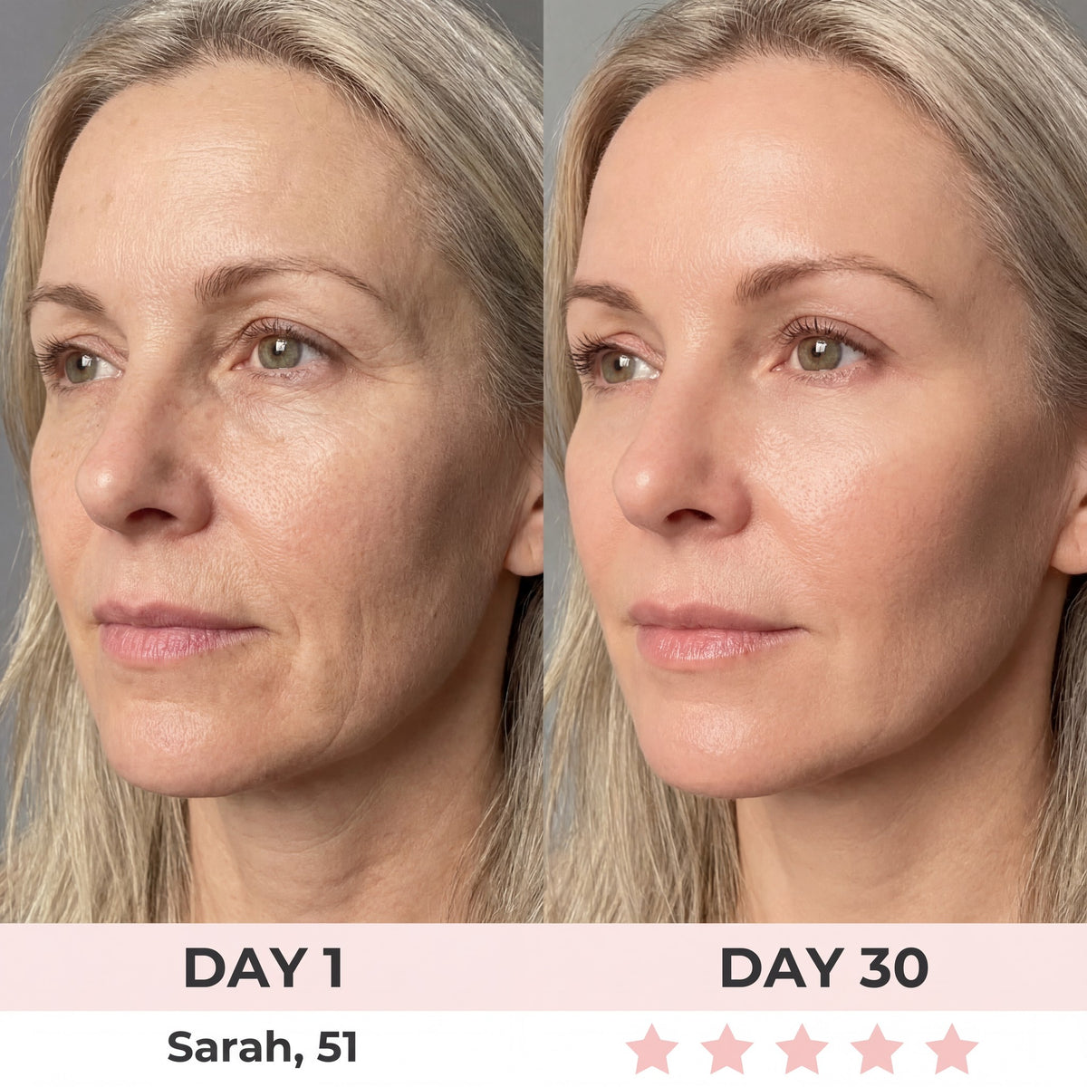 7-in-1 EMS Microcurrent LED Facial Sculptor