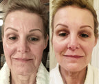 7-in-1 EMS Microcurrent LED Facial Sculptor