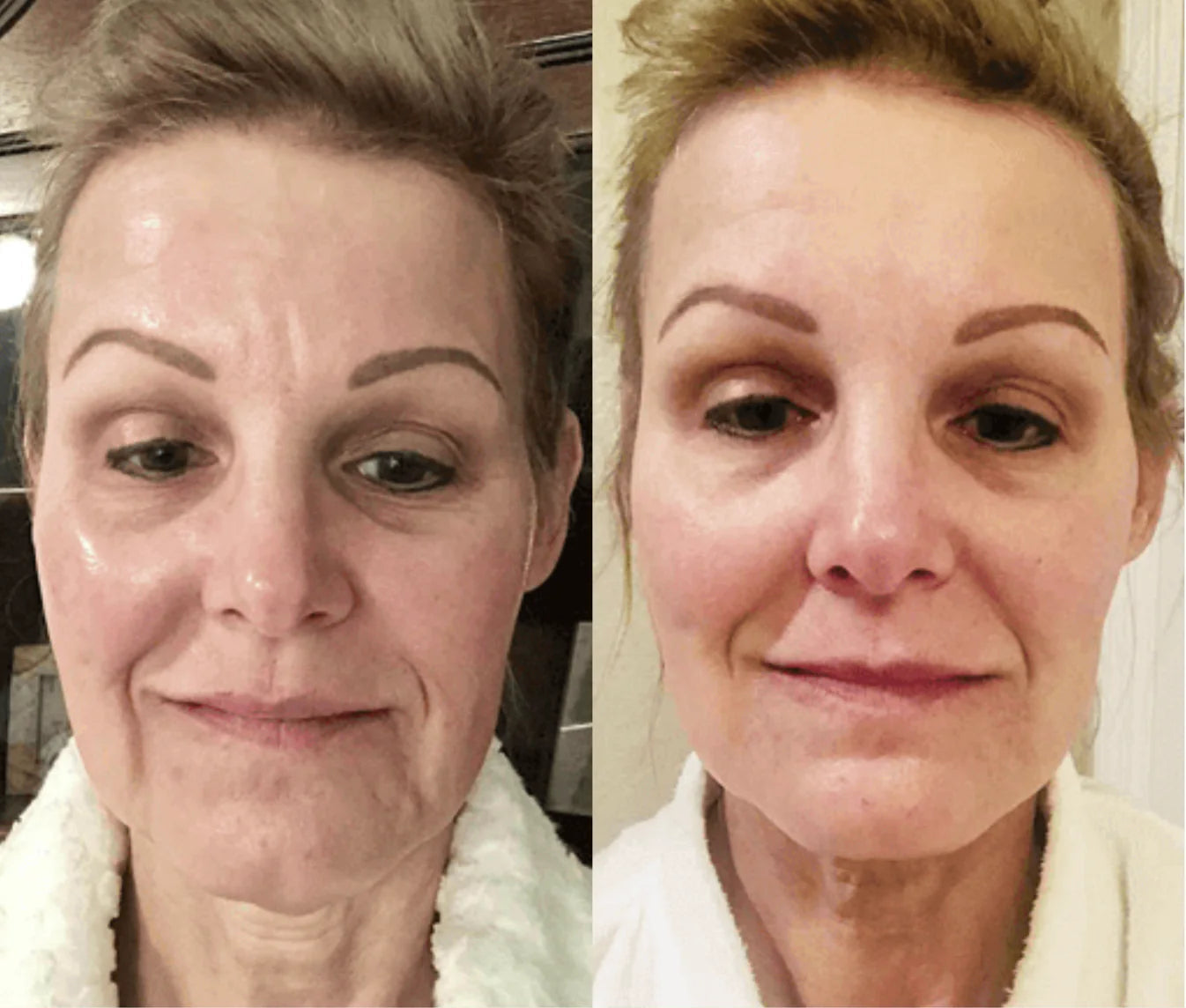 7-in-1 EMS Microcurrent LED Facial Sculptor