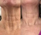 7-in-1 EMS Microcurrent LED Facial Sculptor