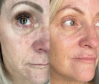 7-in-1 EMS Microcurrent LED Facial Sculptor